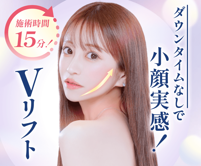 Vリフト（糸リフト6本）