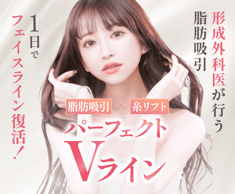 パーフェクトVライン