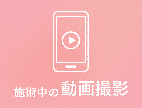 施術中の動画撮影