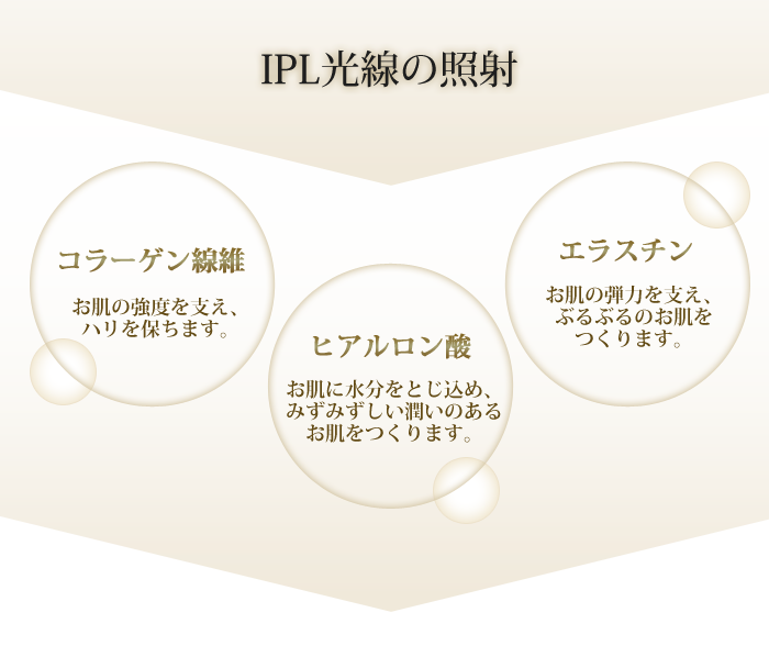 IPL光線の照射