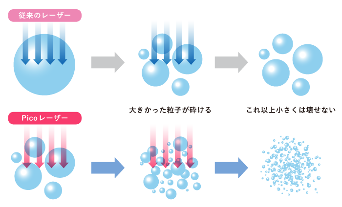 従来のレーザーとピコレーザーの作用イメージ