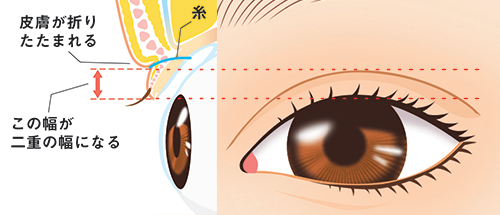 二重のしくみ