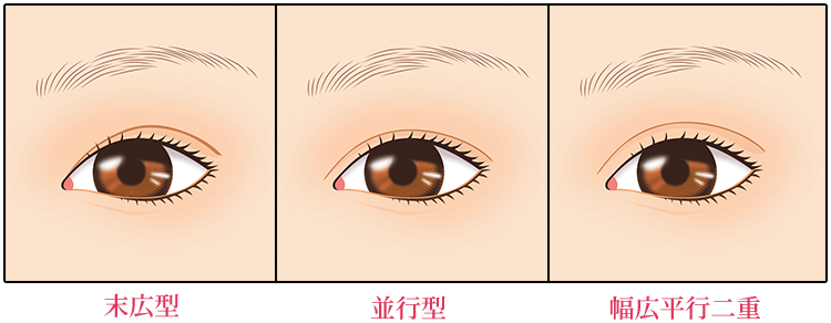 二重のデザイン