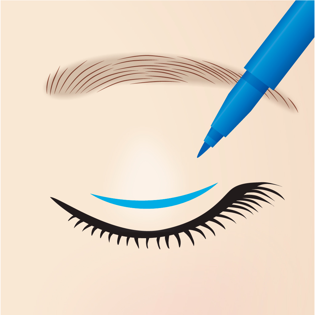 二重切開デザイン