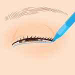 逆さまつ毛修正1