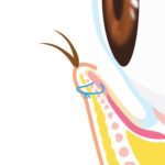 逆さまつ毛修正4