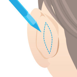 立ち耳マーキング