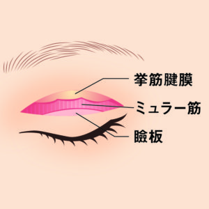 眼瞼下垂症手術03