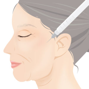 フルフェイスリフトカウンセリング