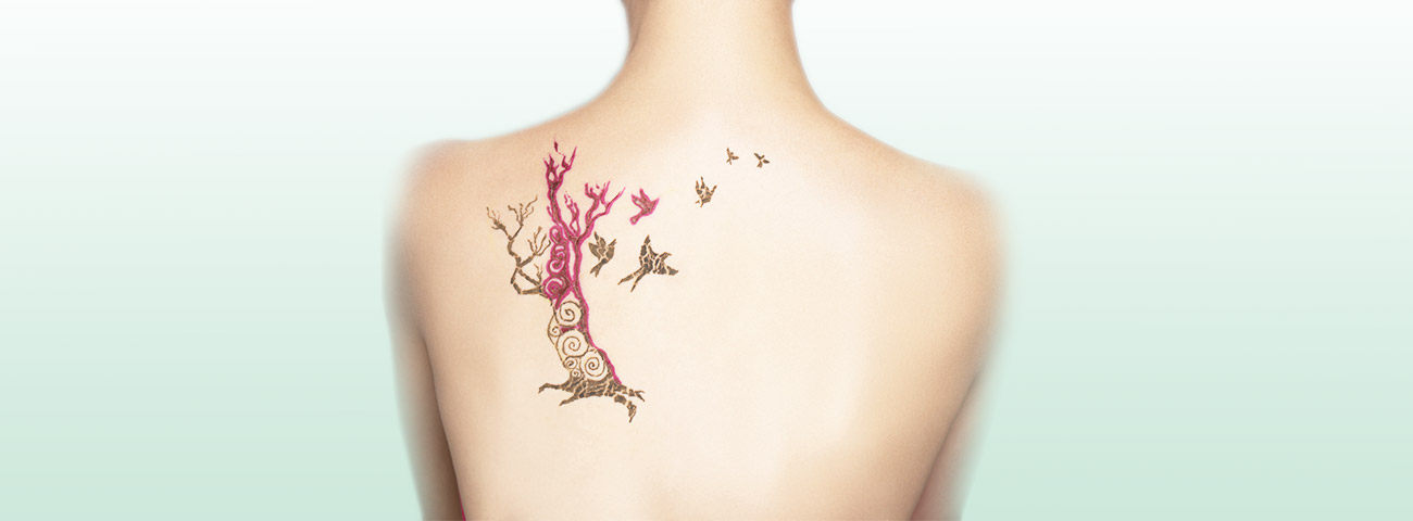 刺青(タトゥー)除去