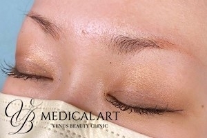 アートメイクビフォー