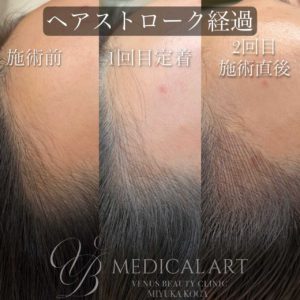 ヘアアートメイク