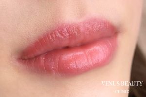 リップアートメイク 施術後