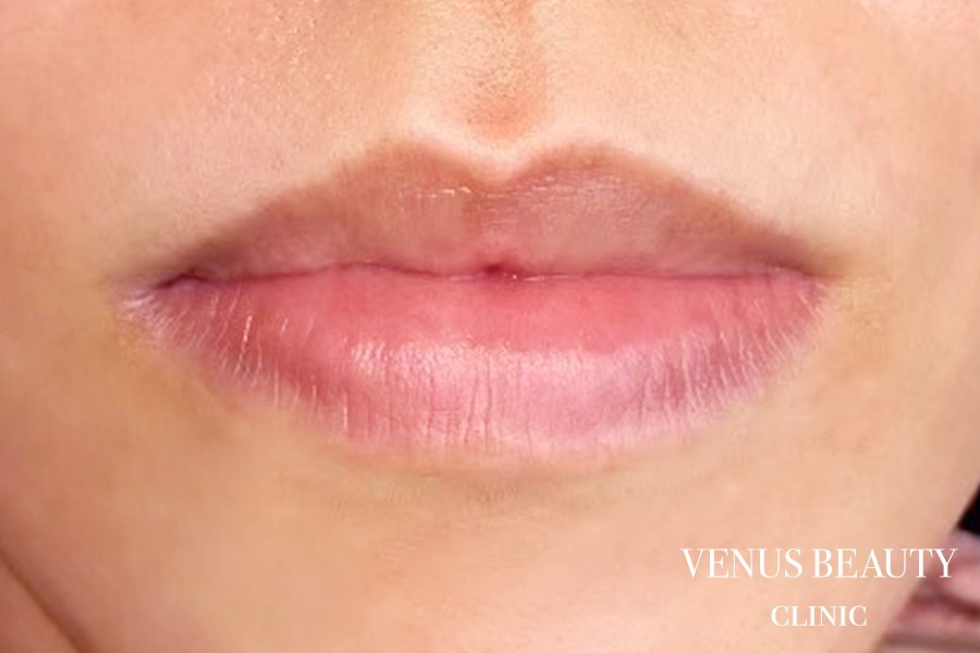 リップアートメイク 施術前