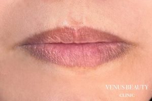 リップアートメイク 施術前