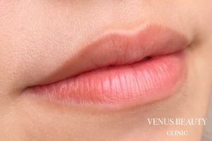 リップアートメイク 施術後
