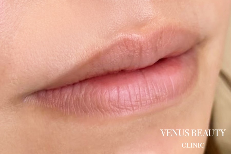 リップアートメイク 施術前