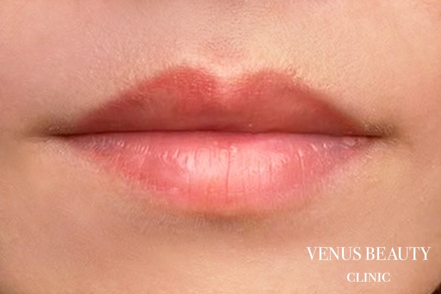 リップアートメイク 施術後