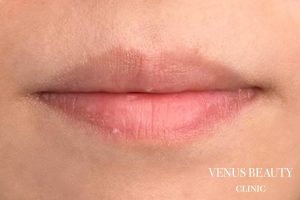 リップアートメイク 施術前