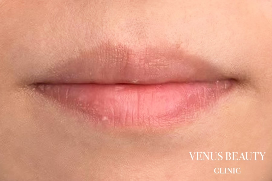 リップアートメイク 施術前