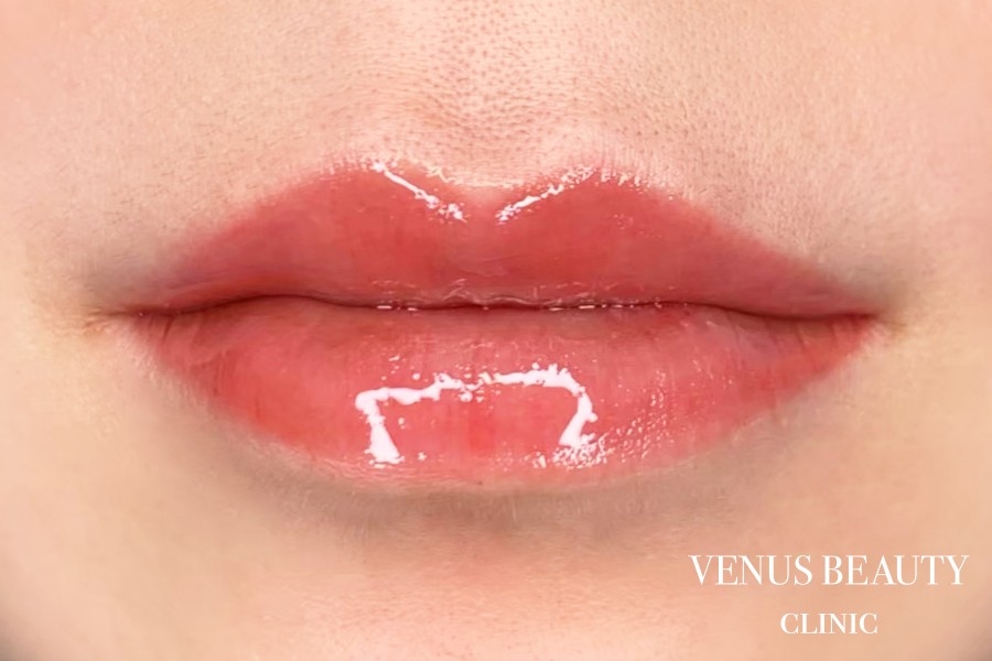 リップアートメイク 施術後