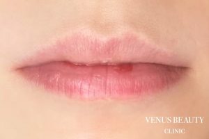 リップアートメイク 施術前