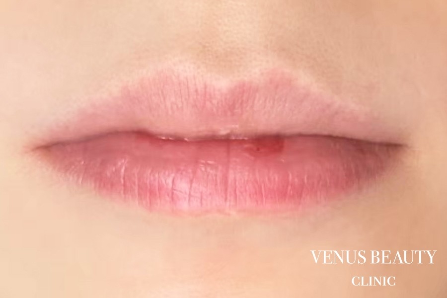 リップアートメイク 施術前