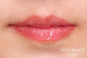 リップアートメイク 施術後