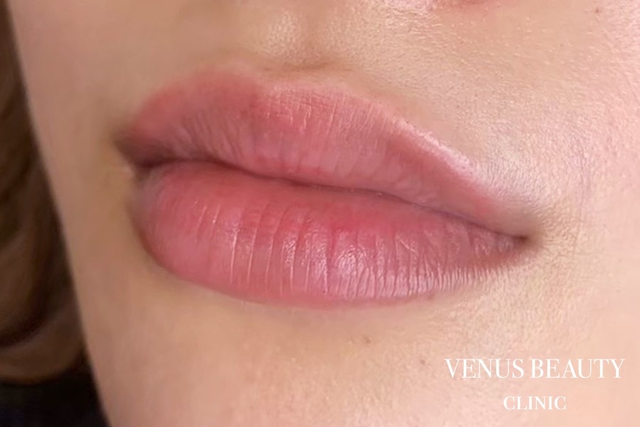 リップアートメイク 施術後