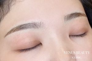 眉アートメイク症例一覧 施術後
