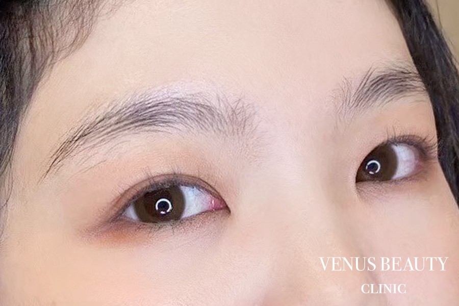 眉アートメイク症例一覧 施術前