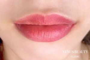 リップアートメイク 施術後