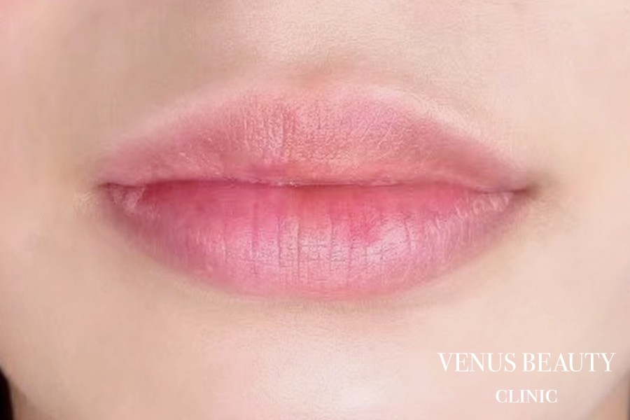 リップアートメイク 施術前