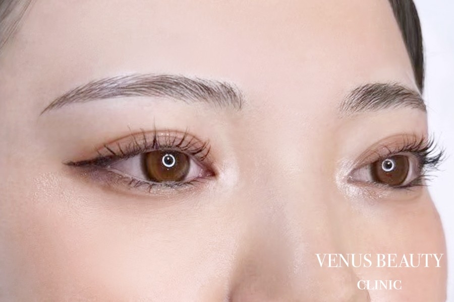 眉アートメイク症例一覧 施術後