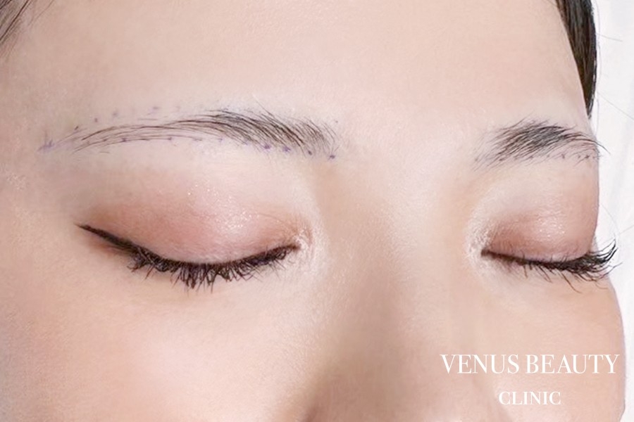 眉アートメイク症例一覧 施術前