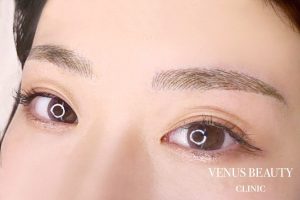 眉アートメイク症例一覧 施術後