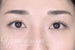 眉アートメイク症例一覧 施術後