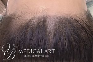 ヘアアートメイク症例一覧 施術後