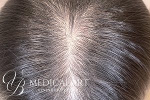 ヘアアートメイク症例一覧 施術前