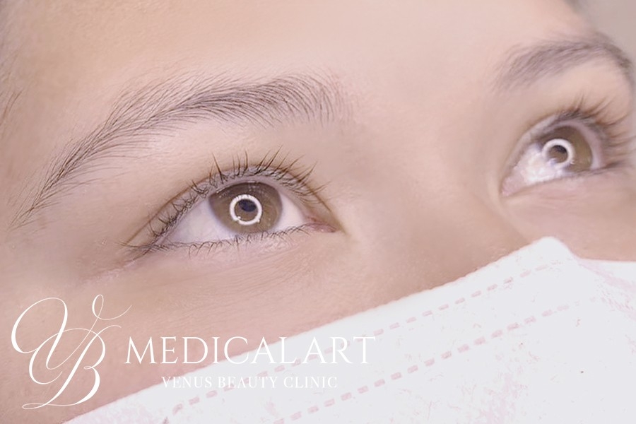 アイラインアートメイク 施術前