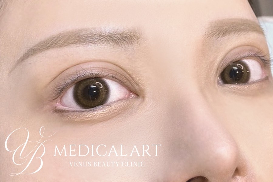 アイラインアートメイク 施術前