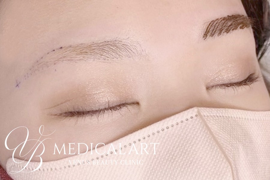 眉アートメイク症例一覧 施術前