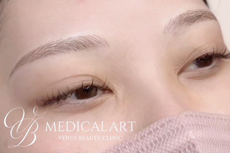 眉アートメイク症例一覧 施術後