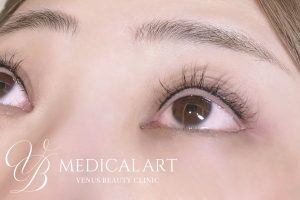 アイラインアートメイク 施術後