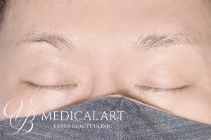 眉アートメイク症例一覧 施術前