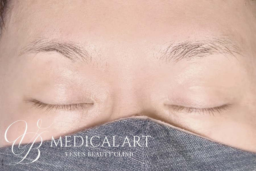 眉アートメイク症例一覧 施術前