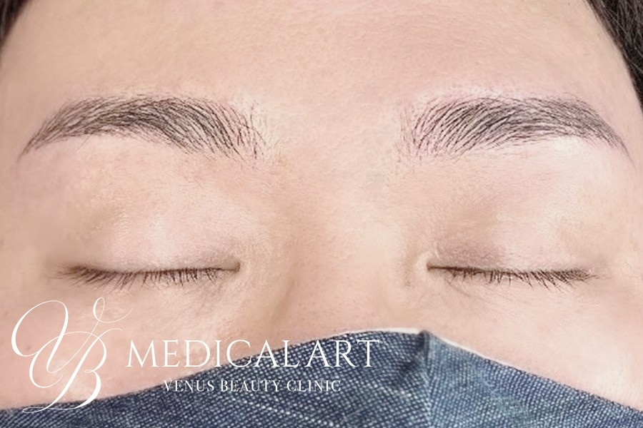 眉アートメイク症例一覧 施術後