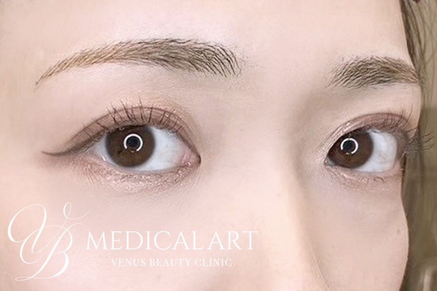 眉アートメイク症例一覧 施術後