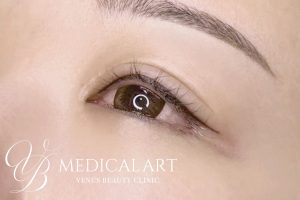 アイラインアートメイク 施術後