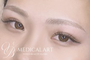 眉アートメイク症例一覧 施術後